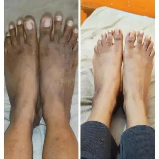 Lucacci Sinche Kojic Skin Whitening Facial Body Soap Pack of 3 - 300 g